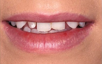 portfolio slider image